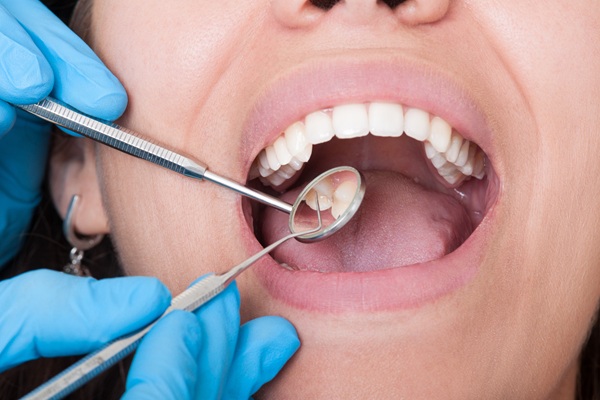 Old Dental Fillings? Common Signs You May Need A New One